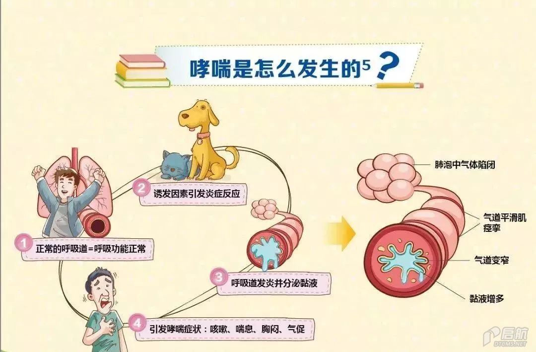 哮喘的综合治疗