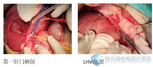 皖北煤电集团总医院